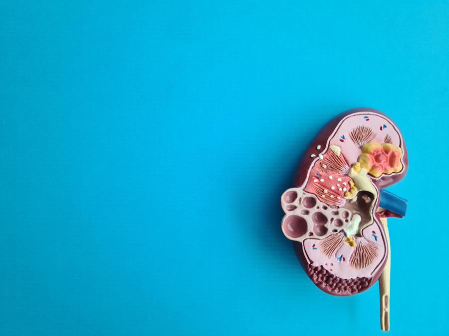 Transplantation rénale : un nouvel espoir pour les patients hyperimmunisés